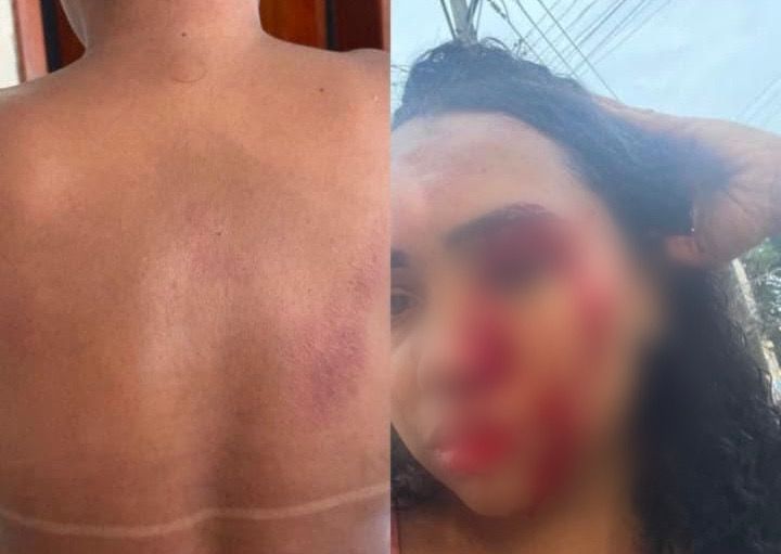 Mulher é agredida ao terminar relacionamento em Cosmos